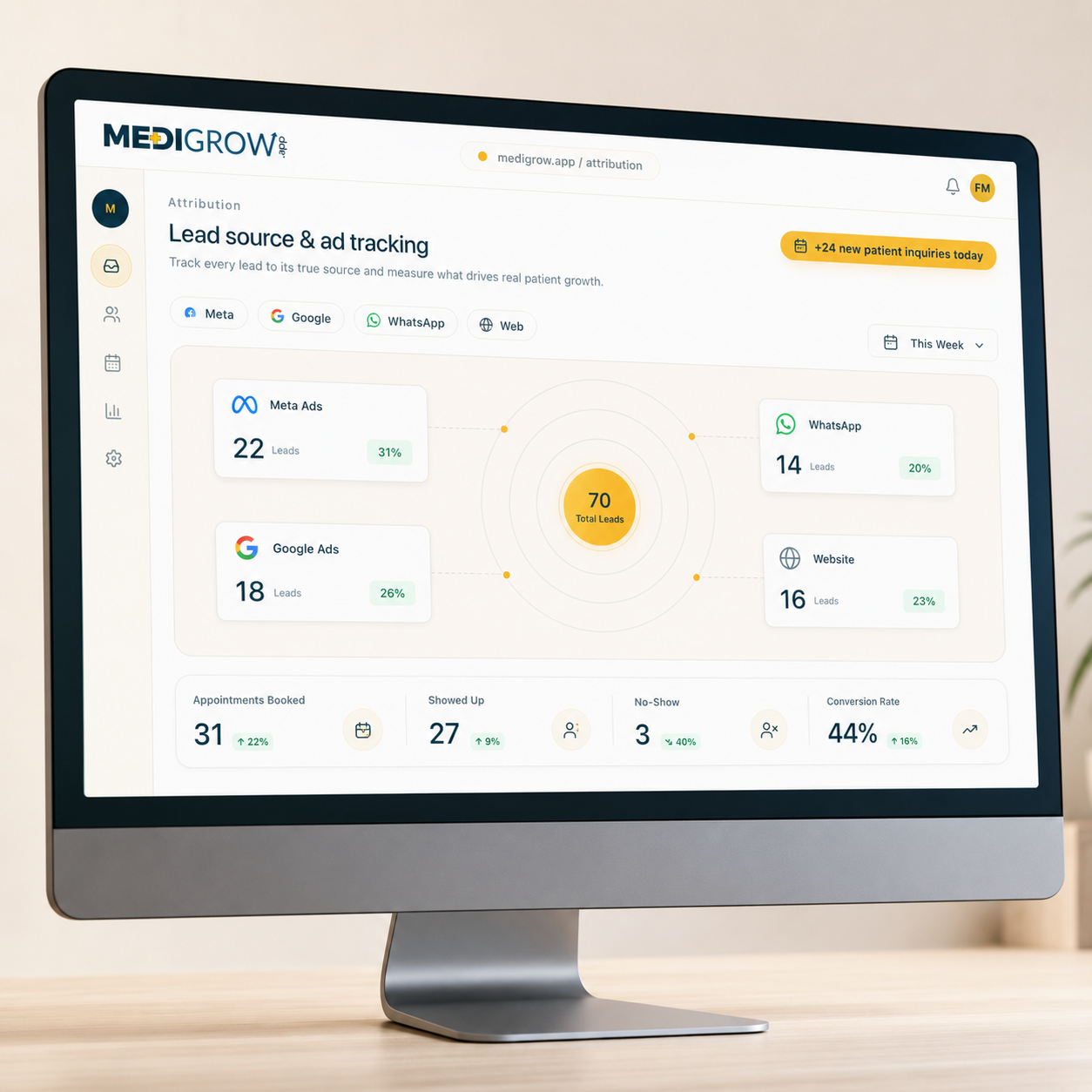 Lead source & ad tracking